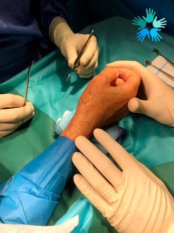 Cirujano de Mano Dr. Sánchez Angulo