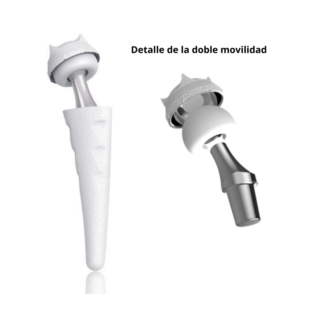 Prótesis para la artrosis del pulgar