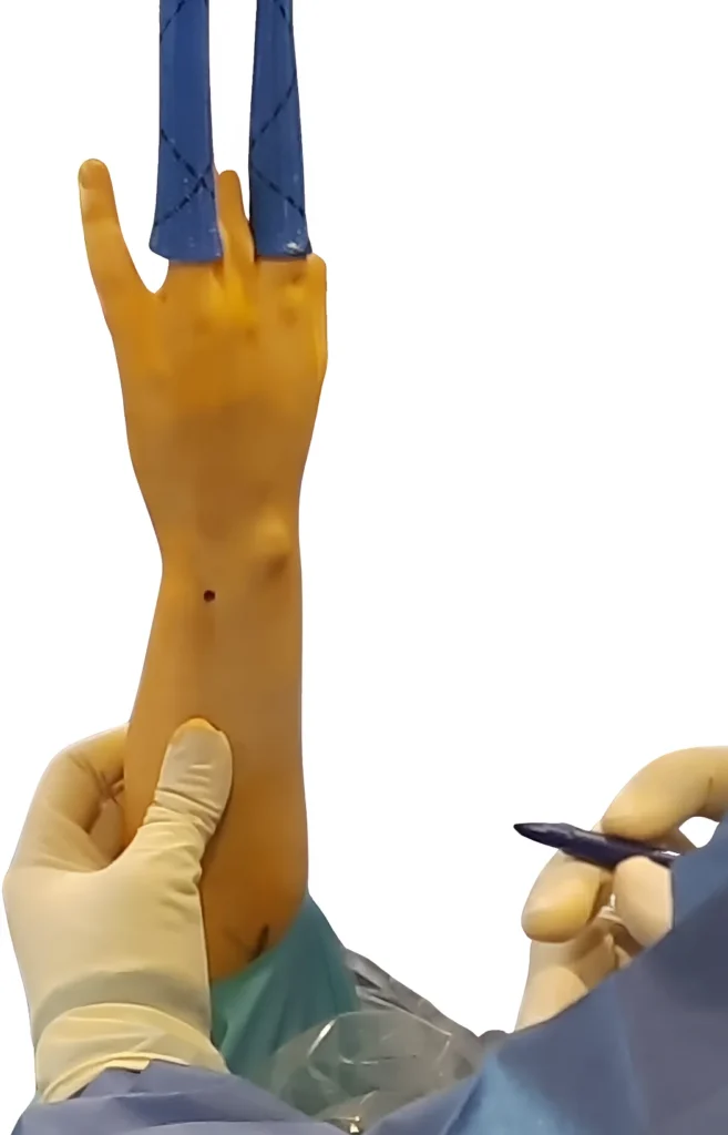 Artroscopia de muñeca y mano